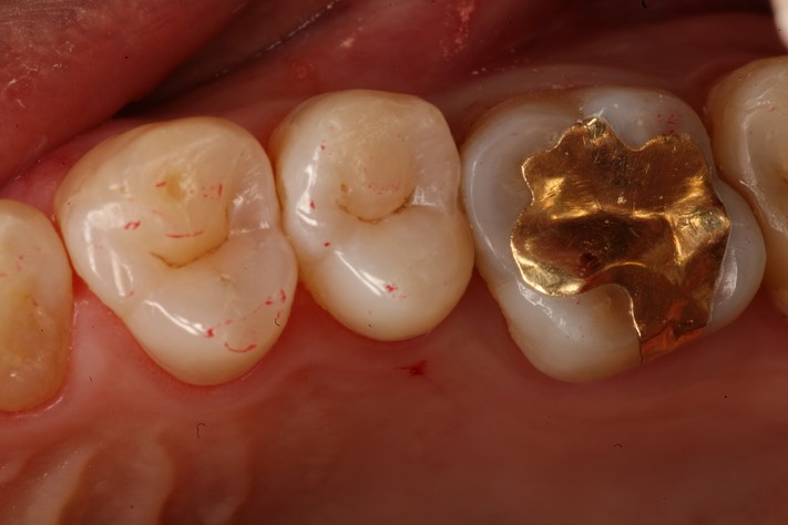 Roland Ylarde #4 pre-op