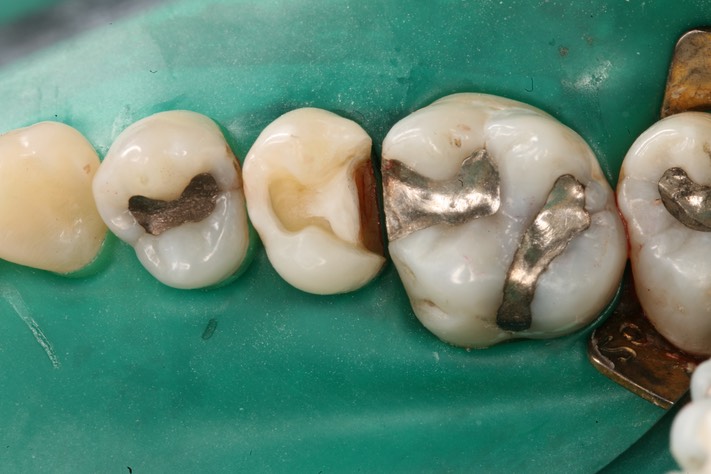 Mitchell Chun #4 prep