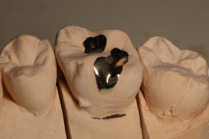 11Kyle Chock #14 castings on model