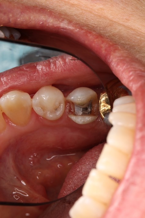 14Mark Chun #20 prep