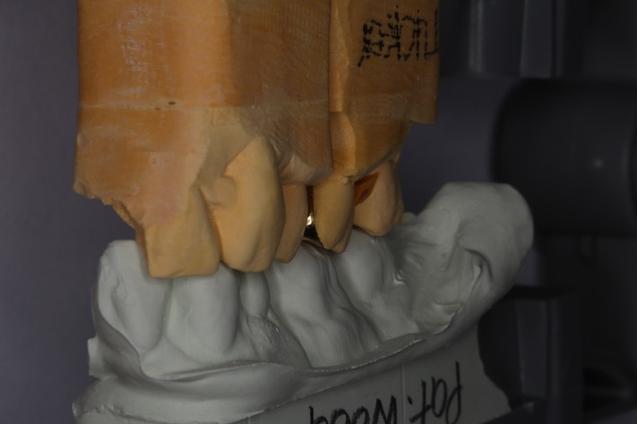 Mark Chun - casting on model 2