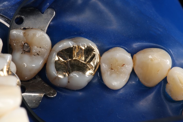 Mark Chun #14 finish