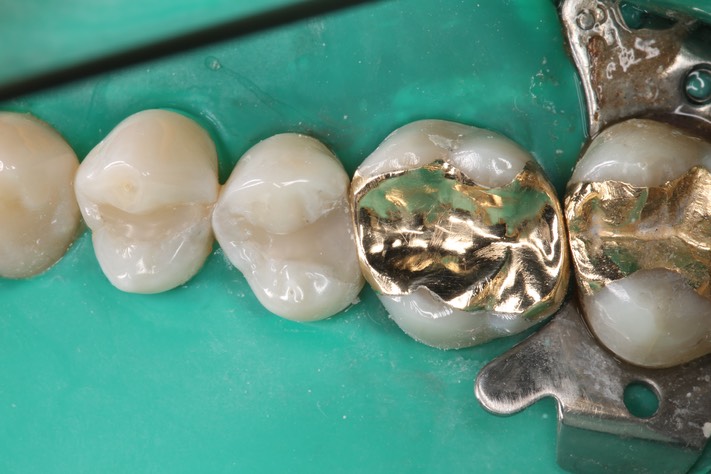 Mendel Sato #3 finish