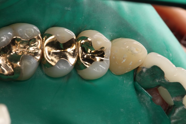 Scott Kanamori #12 finish 2