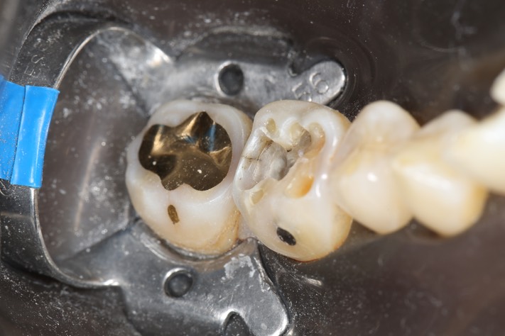 Wes Sato #30 buccal view