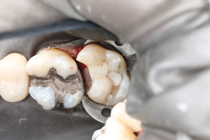 Larry Fujioka #2 prep