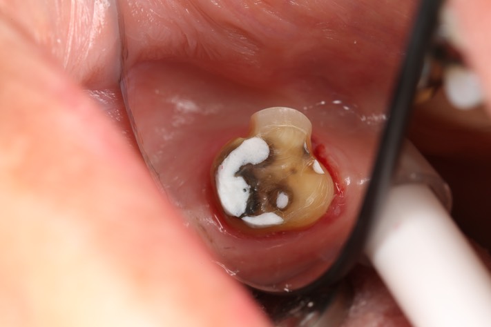 Scott Kanamori #31 prep