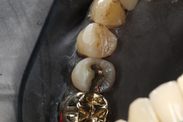 Chris Woo #29 pre-op