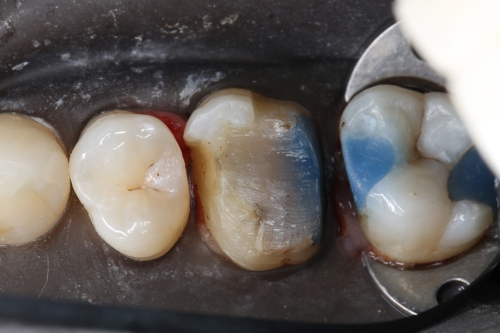 Gary Umeda #3 hollow grind