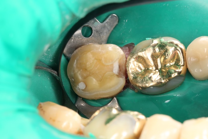 Alan Tamashiro #31 prep