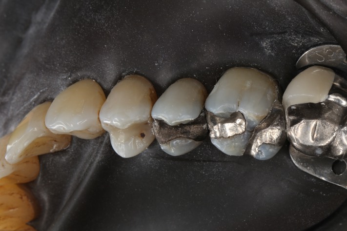 Frank Fukuda #3 pre-op