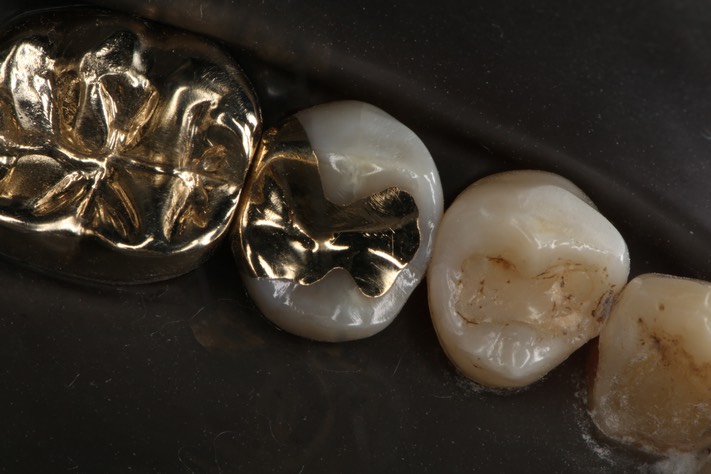 Chris Woo #29 finish