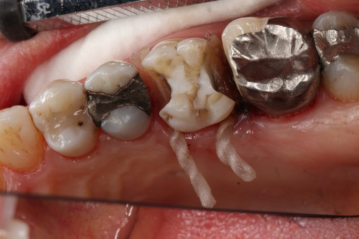 Frank Fukuda #3 prep