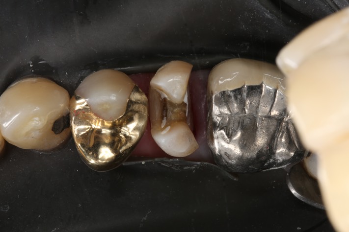 Scott Kanamori #4 prep