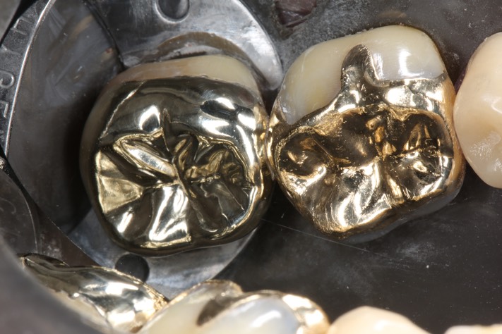 Alan Tamashiro #31 finish