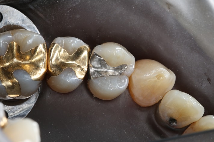 Alan Tamashiro #12 pre-op