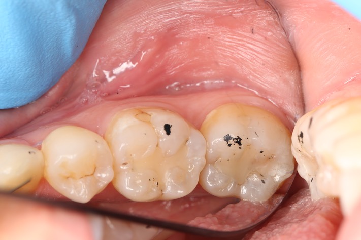 Chris Woo #18 - 19 pre-op