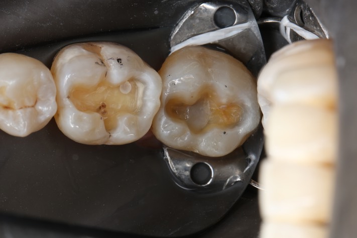 Chris Woo #18 - 19 prep