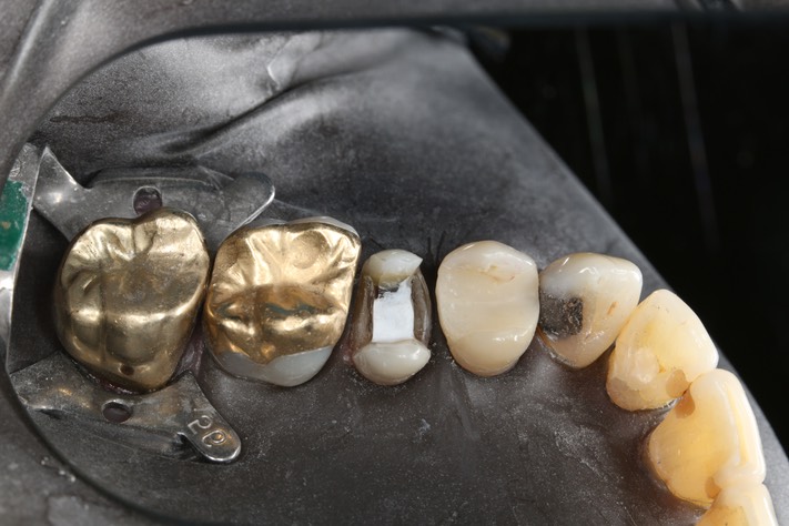 Mendel Sato #13 prep