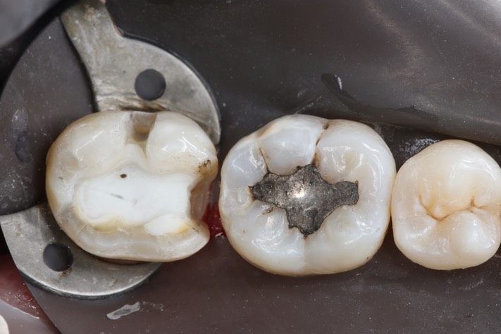 Larry Fujioka #31 prep