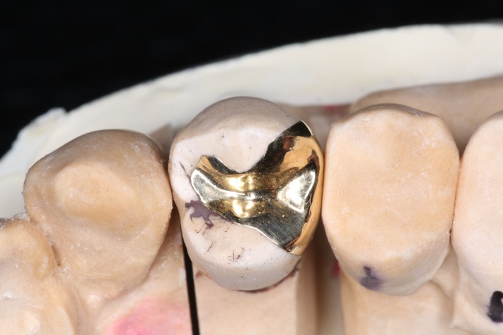 Alan Tamashiro #12 model