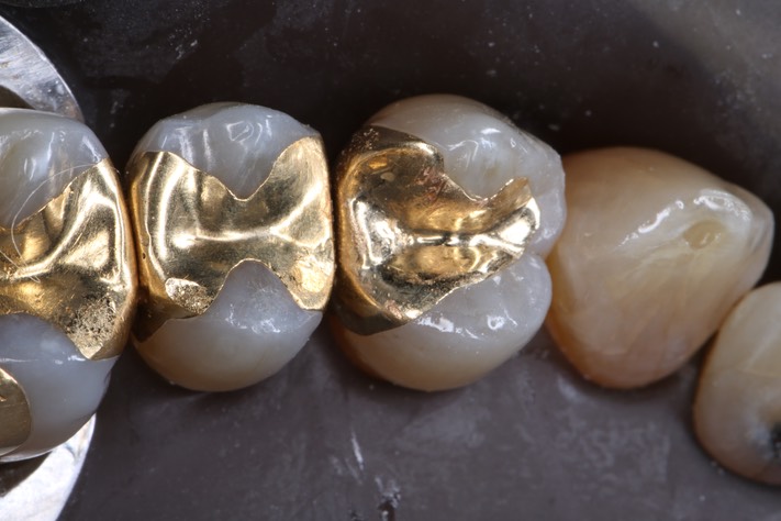 Al Tamashiro #12 finish