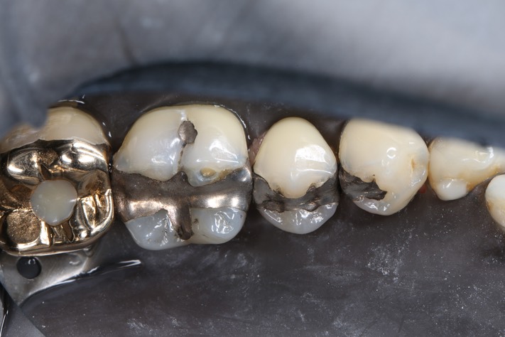 Gary Umeda #30 pre-op