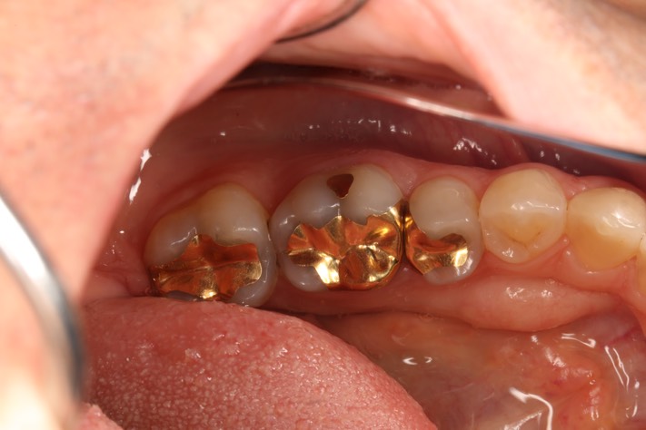 Gary Umeda 29, 30, 31