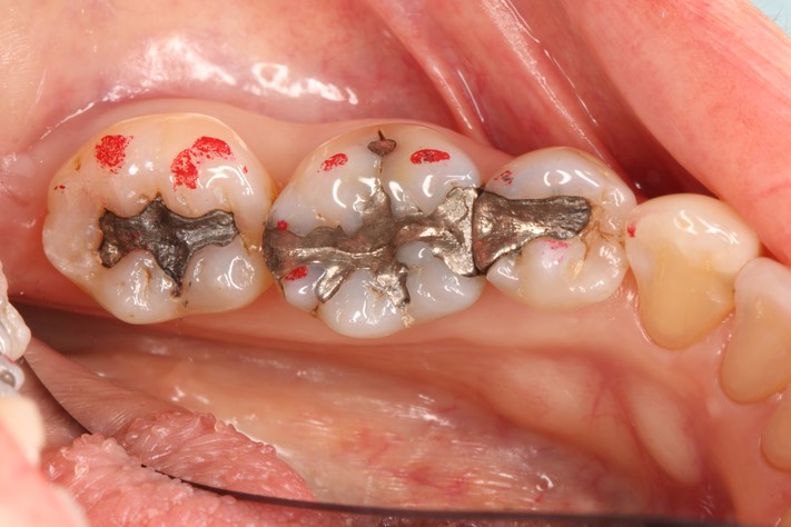 Larry Fujioka #29, 30