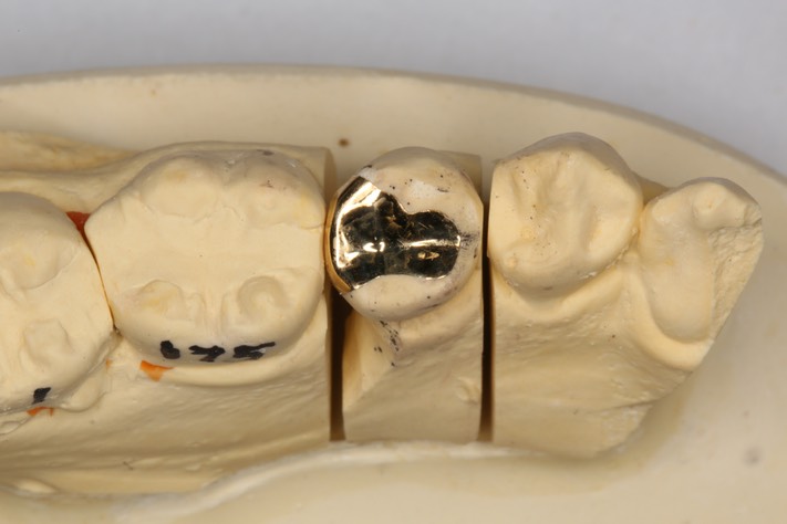 John Wu #20 casting on model