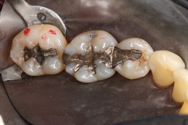 Larry Fujioka #29,30 with dam