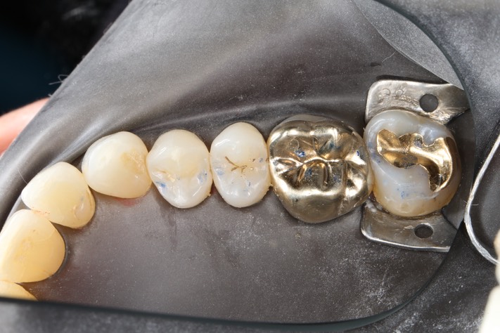 Mason Savage #4 with dam on