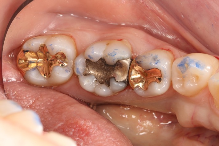 Ted Kanamori #29, 31 casting try in