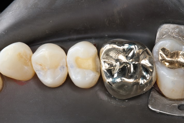 Mason Savage #4 prep