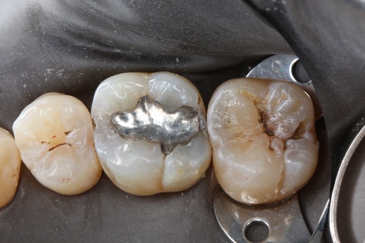 Alan Chinn #3 pre-op