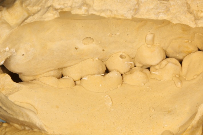 Russ Tabata #18 occlusion