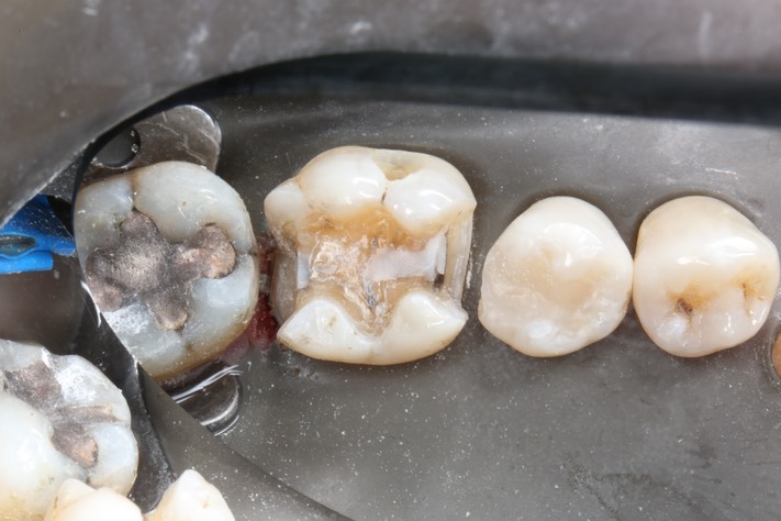 Frank Fukuda #30 prep