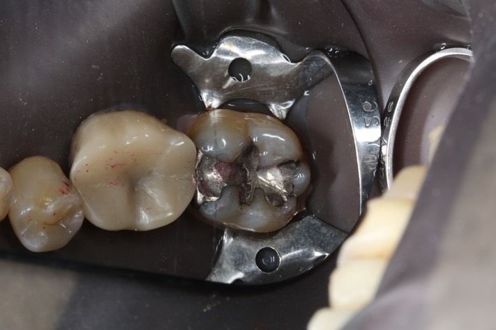 Alan Tamashiro #18 pre-op