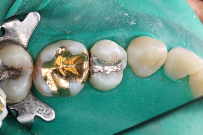 Bryan Sato #13 pre-op