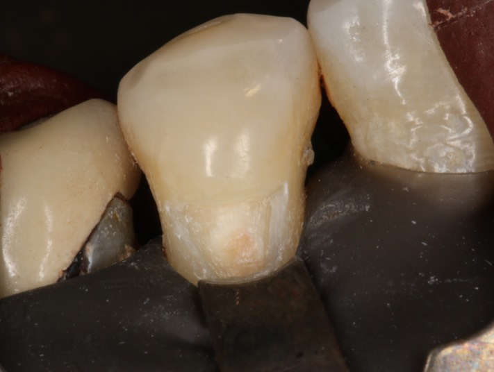 Ted Kanamori #28 prep