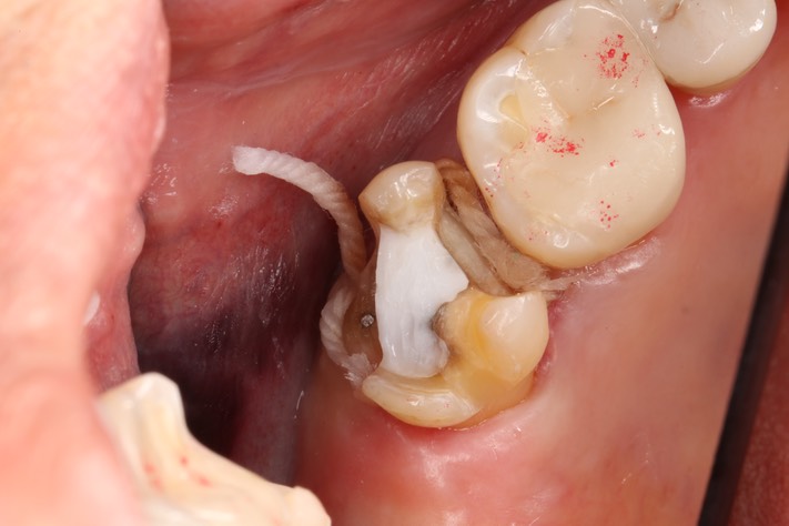 Mendel Sato #15 prep