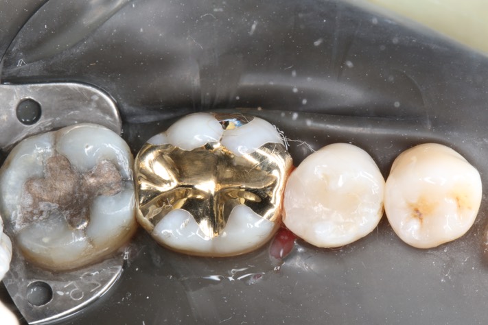 Frank Fukuda #30 finish