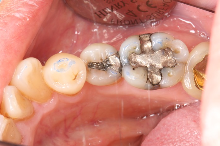 Brian Sato #20 pre-op