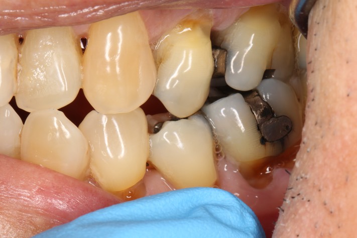 Brian Sato #20 buccal view