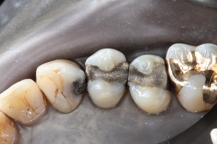 Larry Fujioka #4,5,6 pre-op