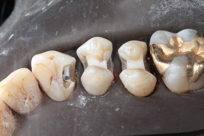 Larry Fujioka #6 prep