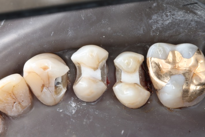 Larry Fujioka #4,5,6 prep