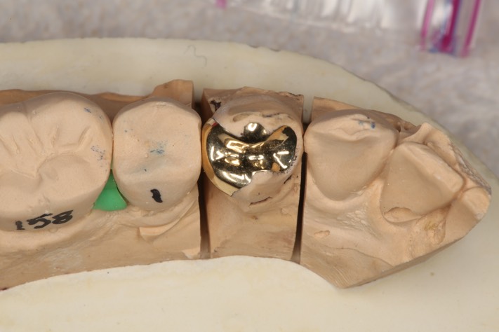 Roland Ylarde 21 casting on model