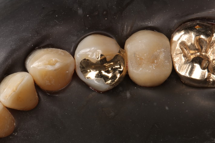 Roland Ylarde #21 finish