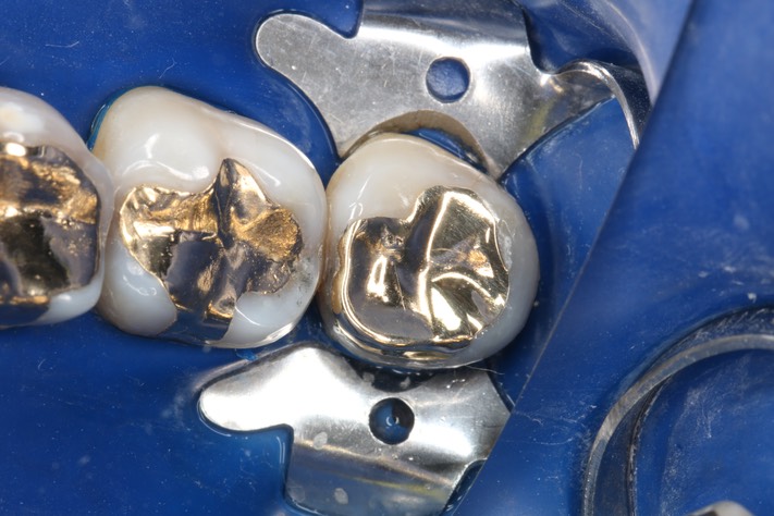 Mark Chun #17 finish